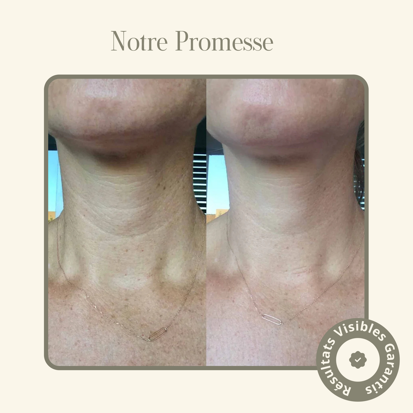 Masque Collagène Cou