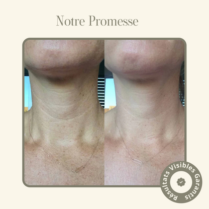 Masque Collagène Cou